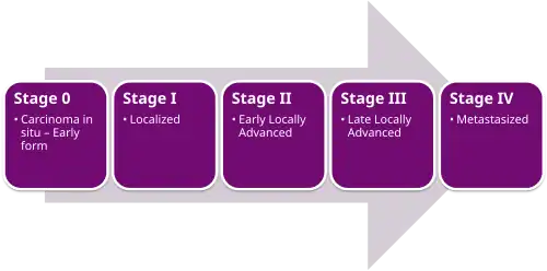 Cancer Stages