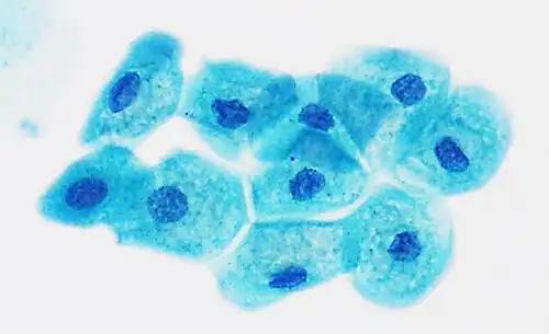 Normal urothelial intermediate cells, Pap stain