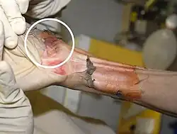 Crime scene photograph showing Rainey's right hand and what appears to be a bruise that could have been caused by him banging at the shower door.