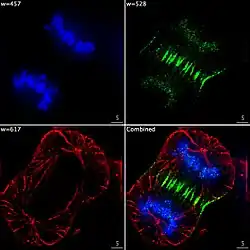 Epifluorescent imaging of the three components in a dividing human cancer cell. DNA is stained blue, a protein called INCENP is green, and the microtubules are red. Each fluorophore is imaged separately using a different combination of excitation and emission filters, and the images are captured sequentially using a digital CCD camera, then superimposed to give a complete image.