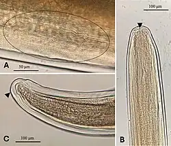 Three microscope images of a roundworm