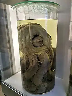 (?/?/1962), Partially digested head of a giant squid recovered from a sperm whale stomach in Durban, South Africa, in 1962; identified by Malcolm Clarke (see label). On display at the London Natural History Museum's Darwin Centre.