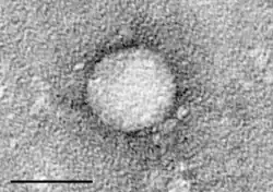 Electron micrograph of Hepatitis C virus purified from cell culture. Scale bar& = 50 nanometres
