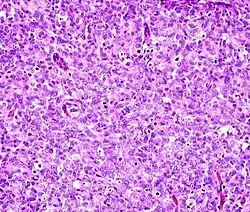 Solid: More or less the same cell type throughout, with no spaces between, and no other particular pattern.