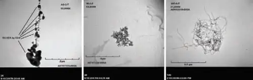 Three greyscale microscope images arranged horizontally. The left two show agglomerations of black spots on a grey background, while the right one shows a mass of tangled fibers.