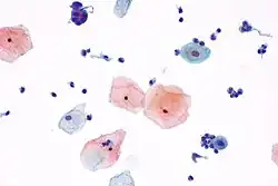 High magnification view