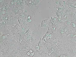 "Neospora caninum"