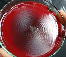 Proteus sp.: swarming behaviour on blood agar: 167