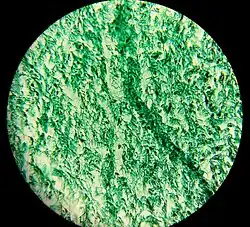 Wharton's jelly - trichrome stain