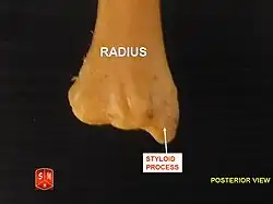 Radius, ulnar notch - posterior view