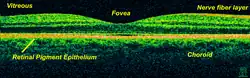 Time-Domain OCT of the macular area of a retina at 800 nm, axial resolution 3 μm