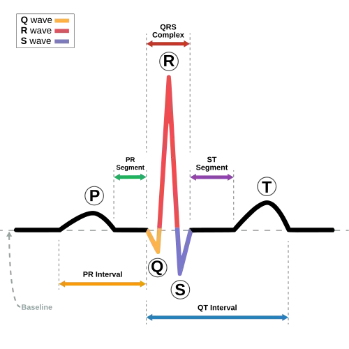 The EKG complex. P=P wave, PR=PR interval, QRS=QRS complex, QT=QT interval, ST=ST segment, T=T wave