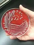 Staphylococcus aureus: large opaque, round, creamy, white to yellowish colonies displaying beta-hemolysis on blood agar: 167–73