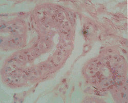Stratified cuboidal epithelium