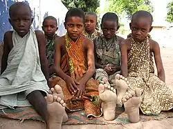 Talibes in Vélingara, Kolda Region, Senegal in 2007