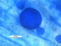 Bilayered glomoid spore of arbuscular mycorrhizal fungi in the root of Horse Gram