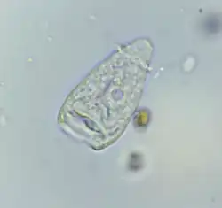 Vorticella sp. telotroch