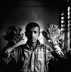 Epidermodysplasia verruciformis patient