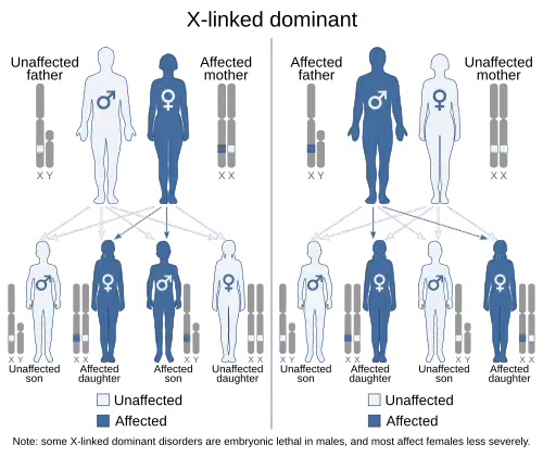 X-linked dominant inheritance scenarios for either the mother or father being affected